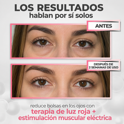 Aurevix® — Rejuvenece tu Mirada