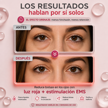 Aurevix® — Rejuvenece tu Mirada