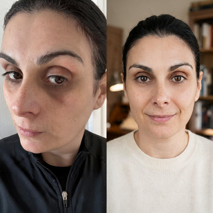 Aurevix® — Rejuvenece tu Mirada
